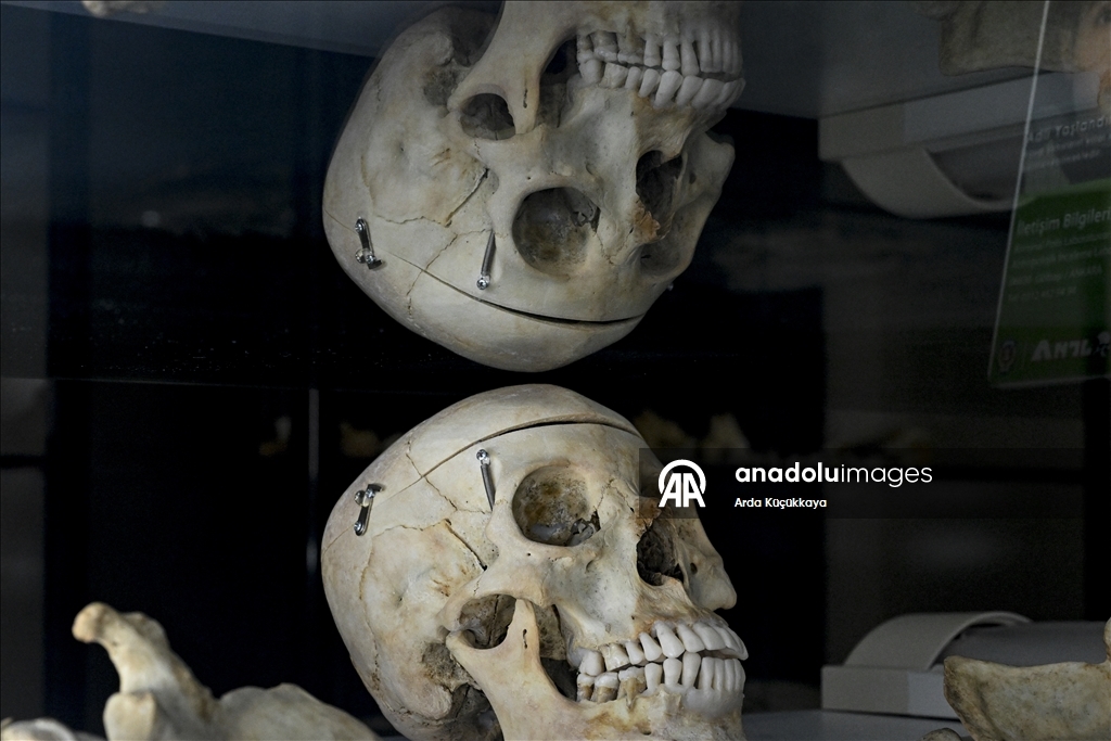 Kayıp yüzlerin arkasındaki faili meçhul cinayetler polis laboratuvarında aydınlatılıyor