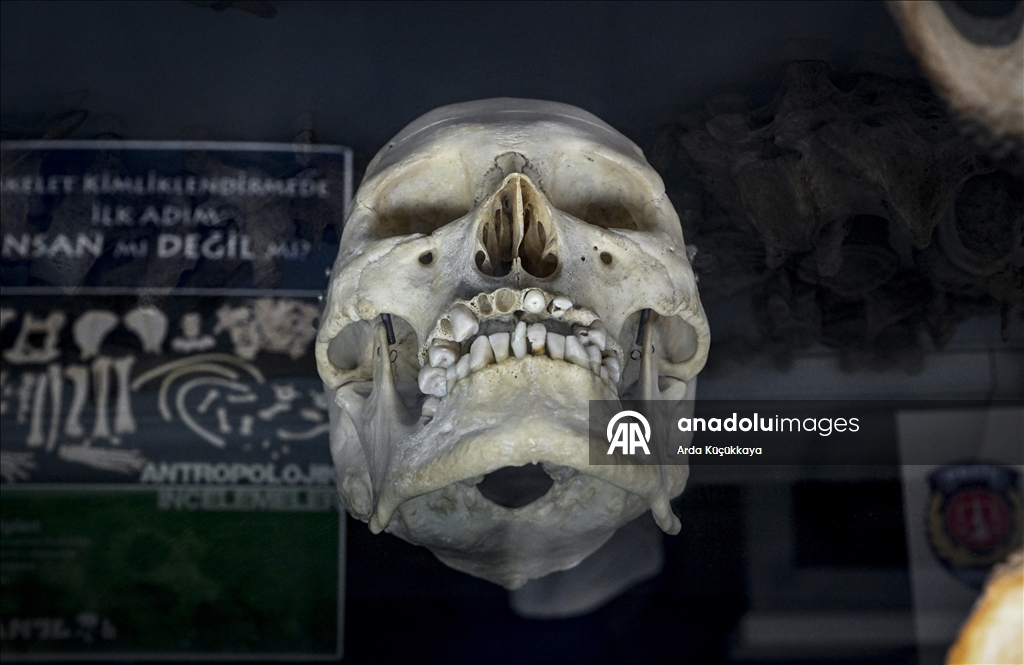 Kayıp yüzlerin arkasındaki faili meçhul cinayetler polis laboratuvarında aydınlatılıyor