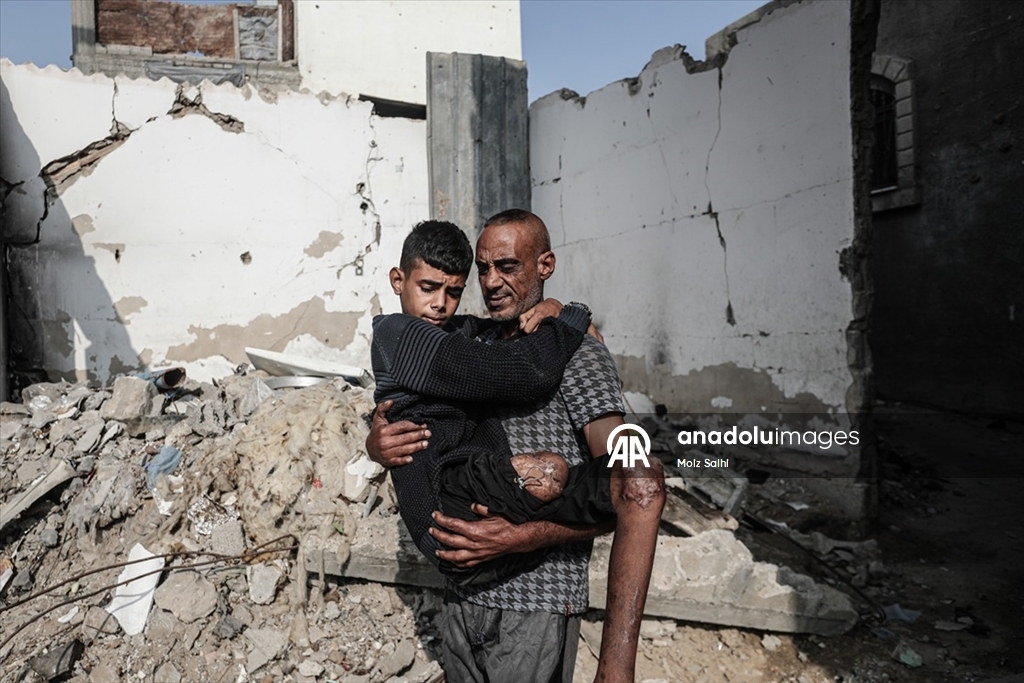 Gazze’de bir bacağını kaybeden Uda’nın diğer bacağı da risk altında