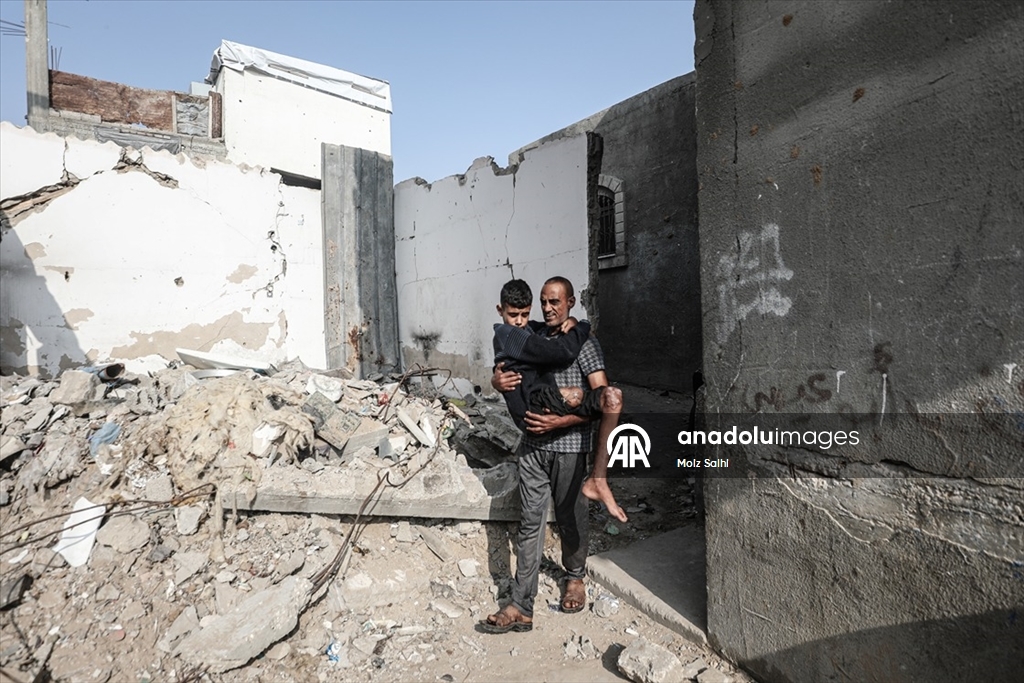 Gazze’de bir bacağını kaybeden Uda’nın diğer bacağı da risk altında