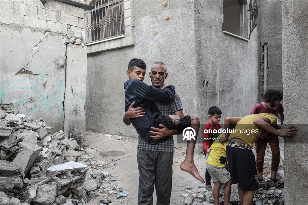 Gazze’de bir bacağını kaybeden Uda’nın diğer bacağı da risk altında