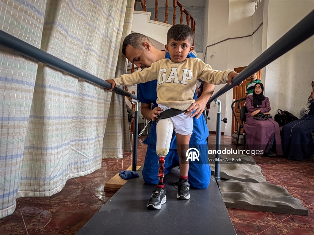 İsrail saldırılarında uzuvlarını kaybeden Gazzeliler abluka nedeniyle gelişmiş protezlere ulaşamıyor