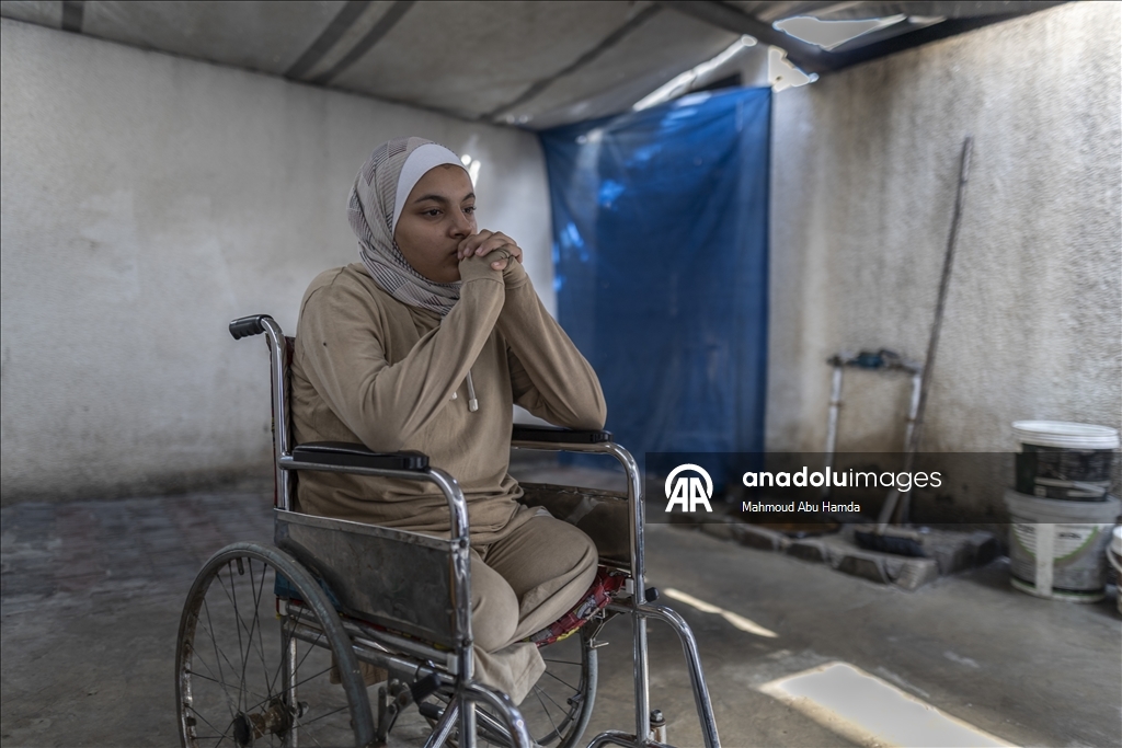 16-летняя палестинка из Газы потеряла семью и обе ноги в результате удара Израиля