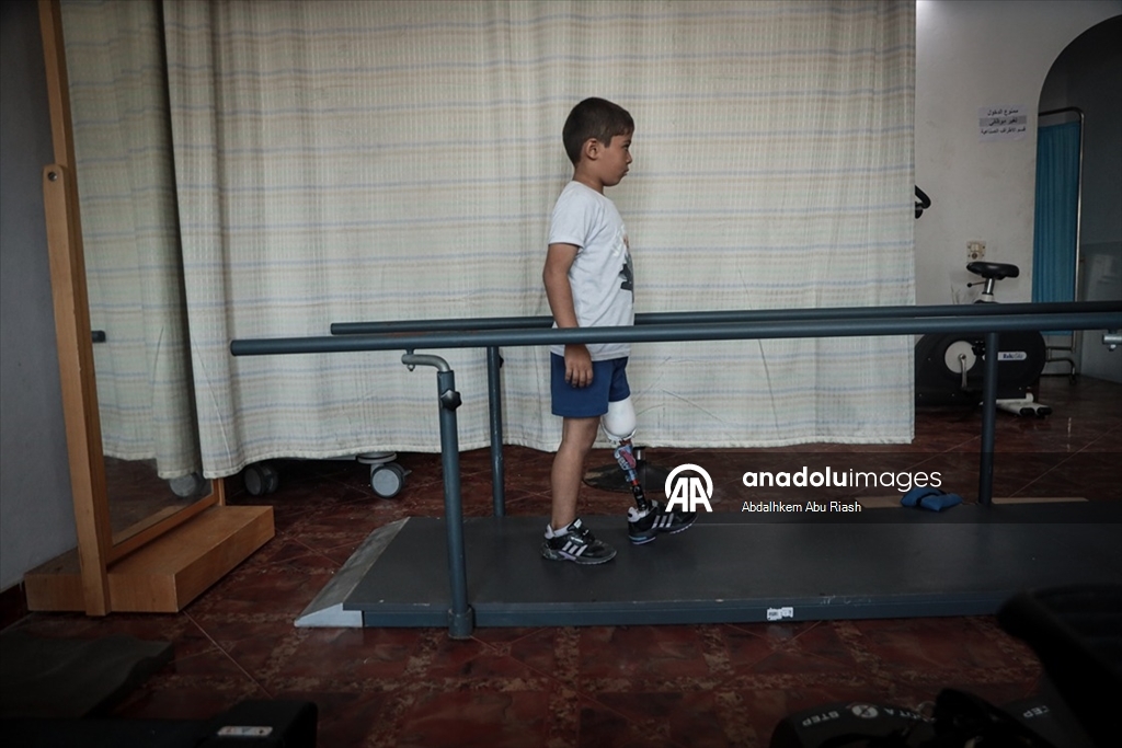 İsrail saldırılarında uzuvlarını kaybeden Gazzeliler abluka nedeniyle gelişmiş protezlere ulaşamıyor