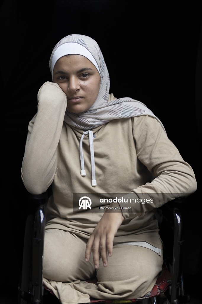 16-летняя палестинка из Газы потеряла семью и обе ноги в результате удара Израиля