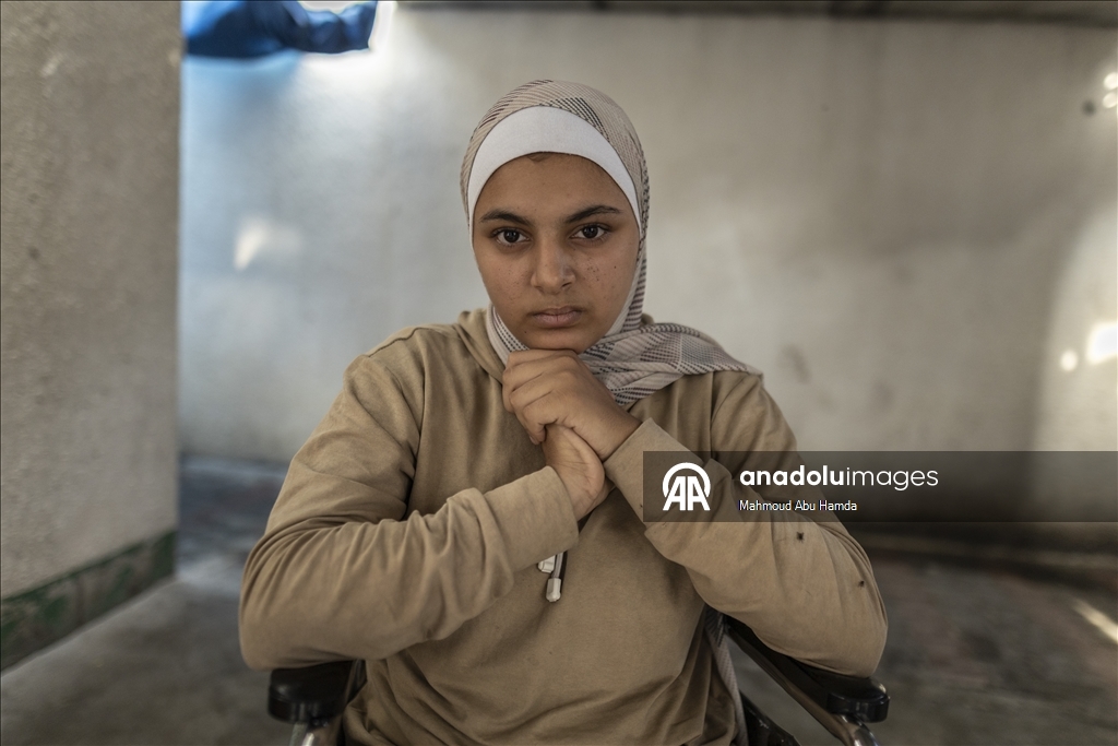 16-летняя палестинка из Газы потеряла семью и обе ноги в результате удара Израиля