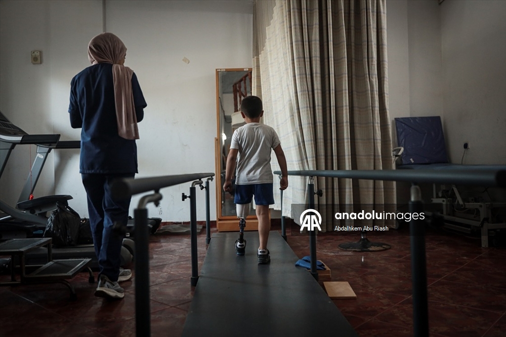 İsrail saldırılarında uzuvlarını kaybeden Gazzeliler abluka nedeniyle gelişmiş protezlere ulaşamıyor