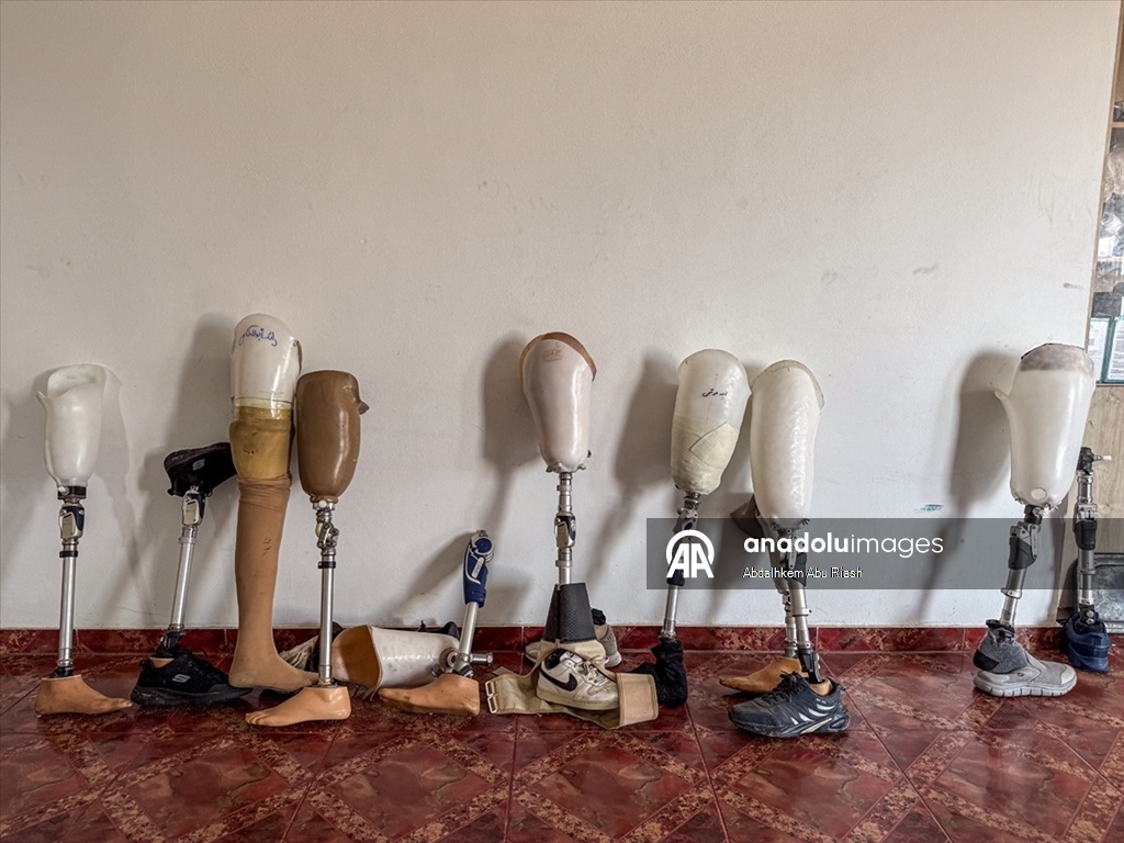 İsrail saldırılarında uzuvlarını kaybeden Gazzeliler abluka nedeniyle gelişmiş protezlere ulaşamıyor