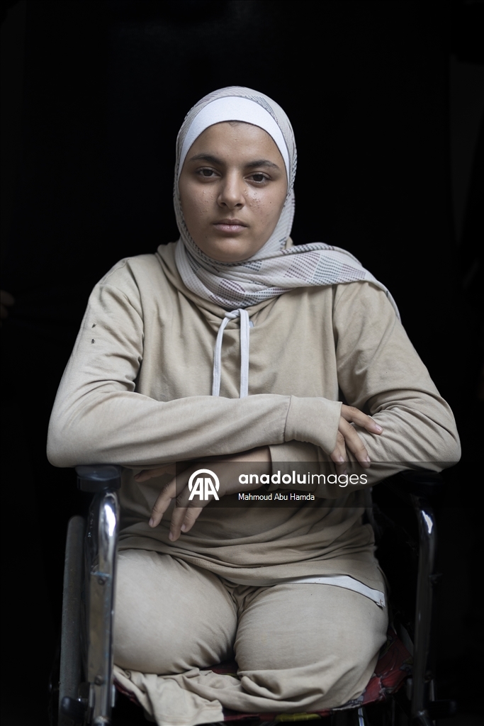16-летняя палестинка из Газы потеряла семью и обе ноги в результате удара Израиля