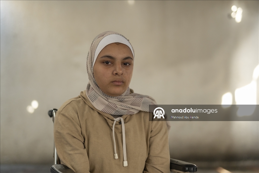 16-летняя палестинка из Газы потеряла семью и обе ноги в результате удара Израиля