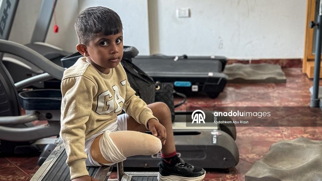 İsrail saldırılarında uzuvlarını kaybeden Gazzeliler abluka nedeniyle gelişmiş protezlere ulaşamıyor