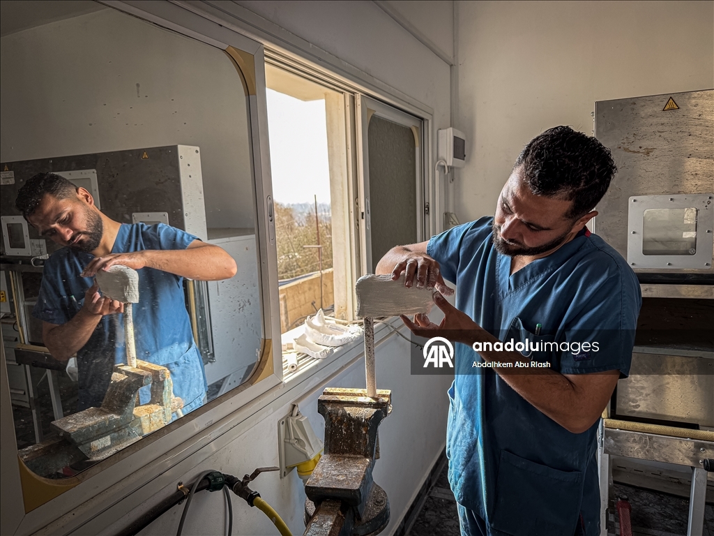 Тысячи палестинцев, потерявших конечности ожидают получения протезов.