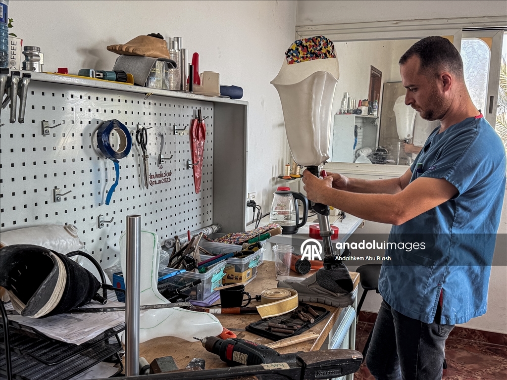 Тысячи палестинцев, потерявших конечности ожидают получения протезов.