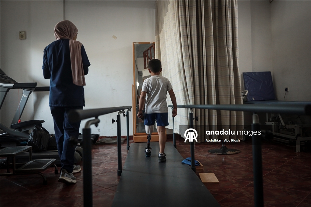 Тысячи палестинцев, потерявших конечности ожидают получения протезов.