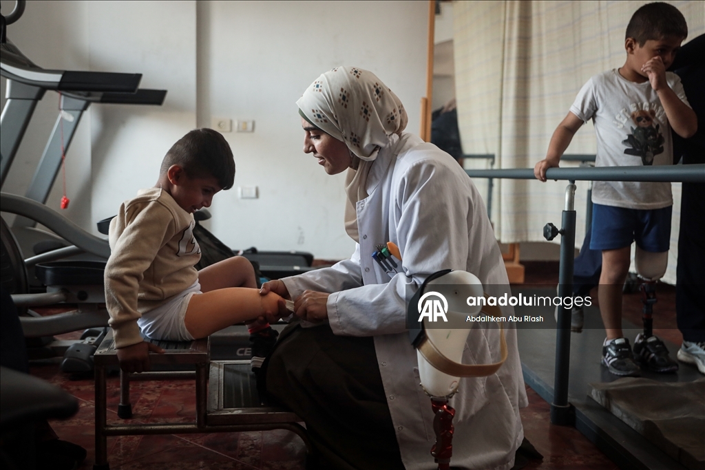 Тысячи палестинцев, потерявших конечности ожидают получения протезов.