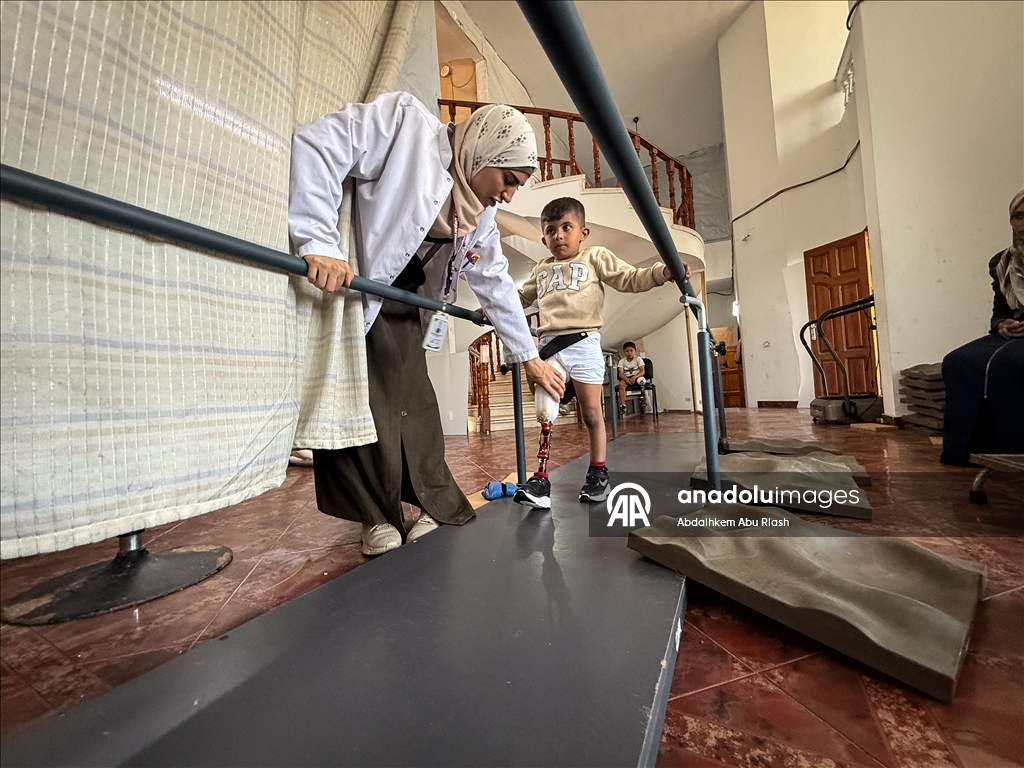 Тысячи палестинцев, потерявших конечности ожидают получения протезов.