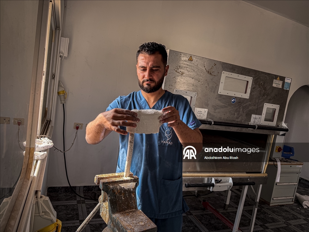 Тысячи палестинцев, потерявших конечности ожидают получения протезов.