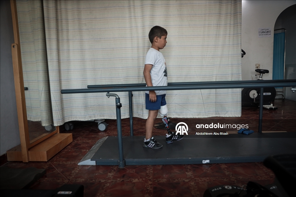 Тысячи палестинцев, потерявших конечности ожидают получения протезов