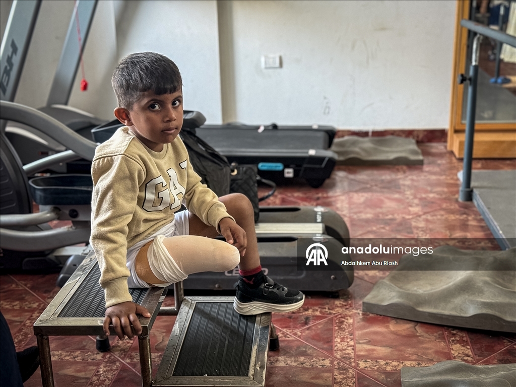 Тысячи палестинцев, потерявших конечности ожидают получения протезов.