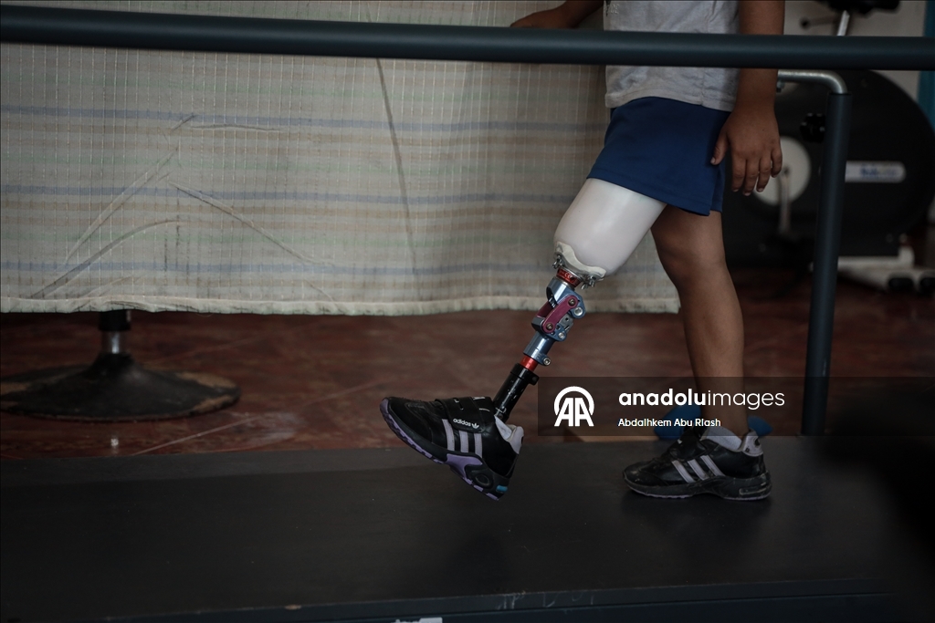 Тысячи палестинцев, потерявших конечности ожидают получения протезов.