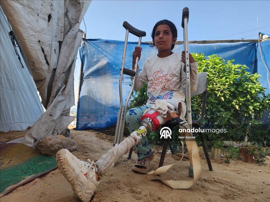 İsrail saldırısı sonucu yaralanan Filistinli kardeşler, tedavi olmayı bekliyor