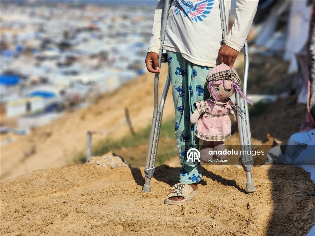 İsrail saldırısı sonucu yaralanan Filistinli kardeşler, tedavi olmayı bekliyor