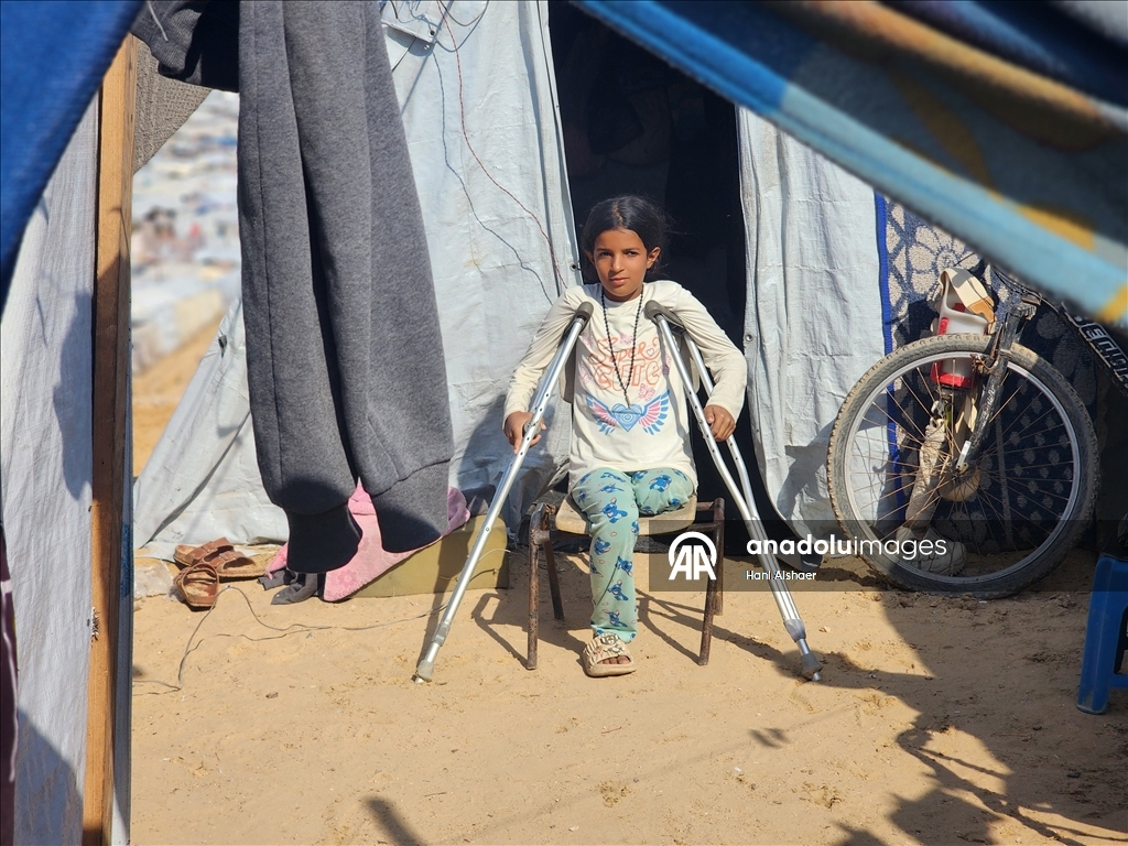 İsrail saldırısı sonucu yaralanan Filistinli kardeşler, tedavi olmayı bekliyor