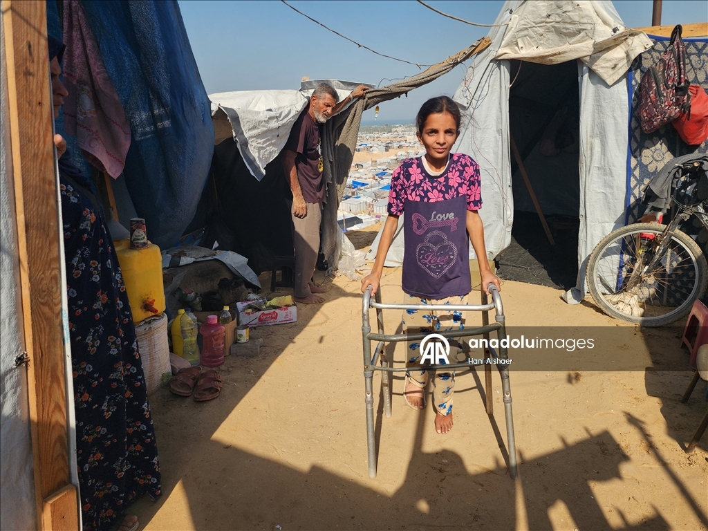 İsrail saldırısı sonucu yaralanan Filistinli kardeşler, tedavi olmayı bekliyor