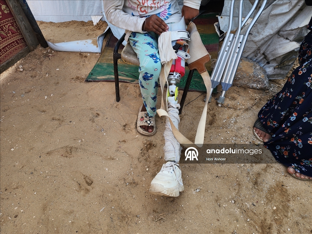 İsrail saldırısı sonucu yaralanan Filistinli kardeşler, tedavi olmayı bekliyor