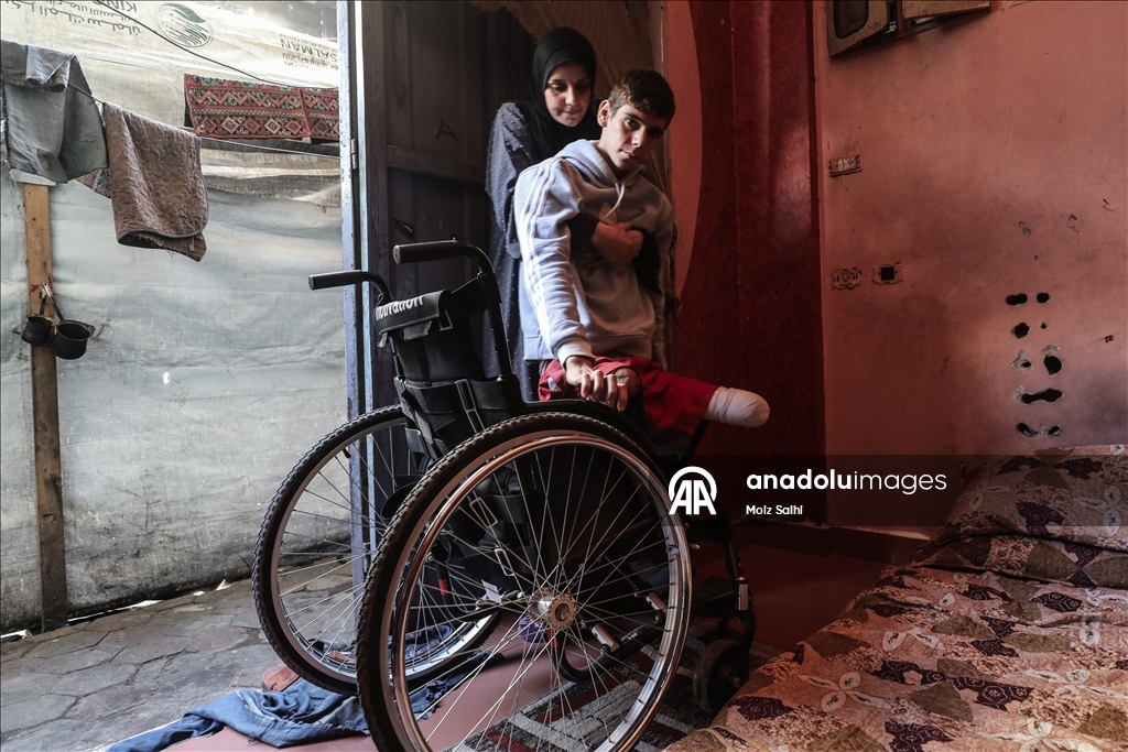 Потерявший обе ноги палестинец надеется на лечение за рубежом