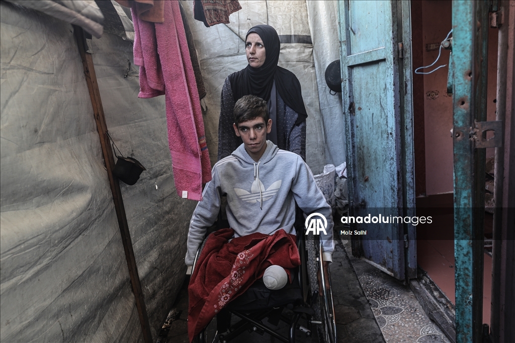 Потерявший обе ноги палестинец надеется на лечение за рубежом