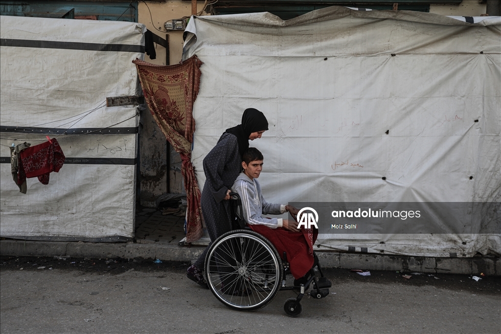 Потерявший обе ноги палестинец надеется на лечение за рубежом