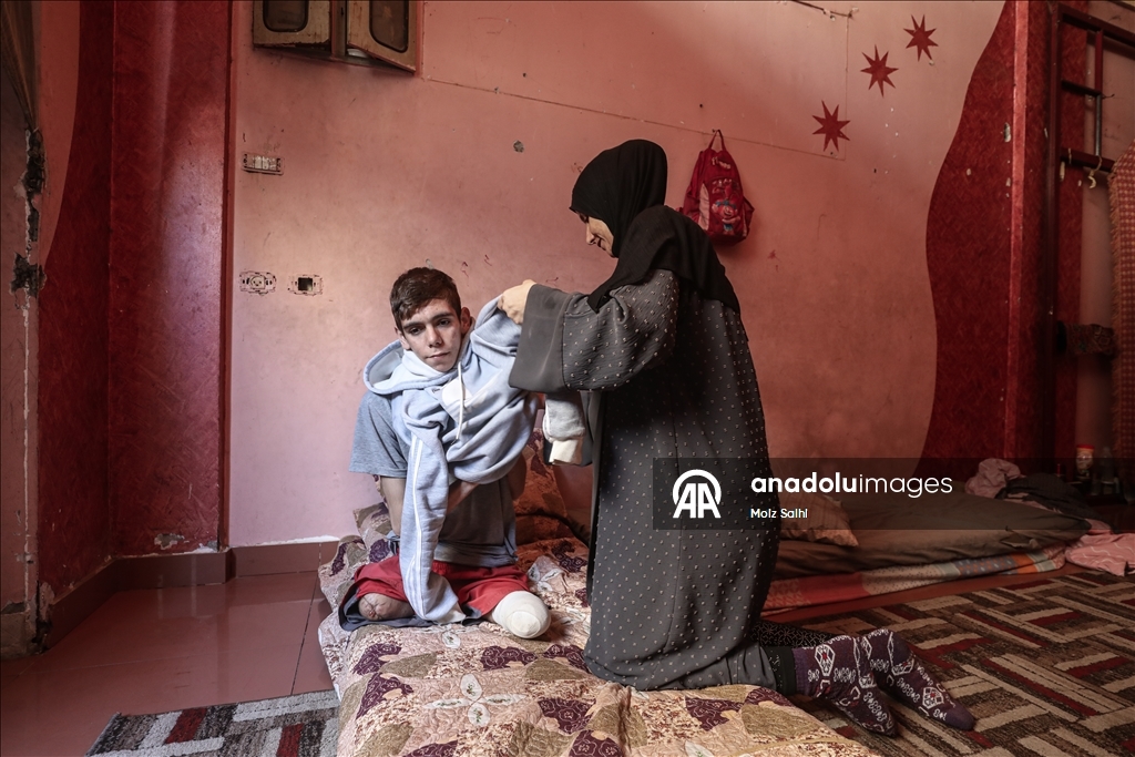 Потерявший обе ноги палестинец надеется на лечение за рубежом