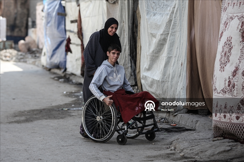 Потерявший обе ноги палестинец надеется на лечение за рубежом