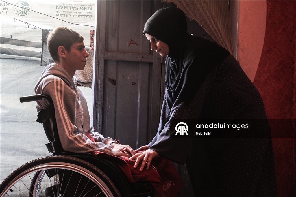 Потерявший обе ноги палестинец надеется на лечение за рубежом