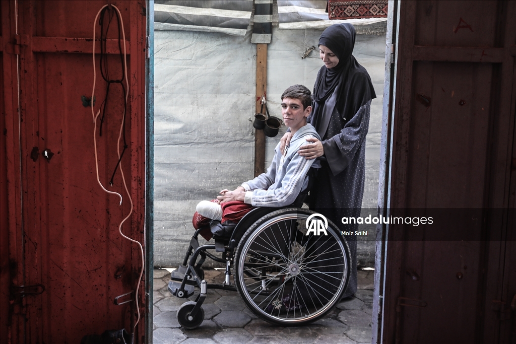 Потерявший обе ноги палестинец надеется на лечение за рубежом