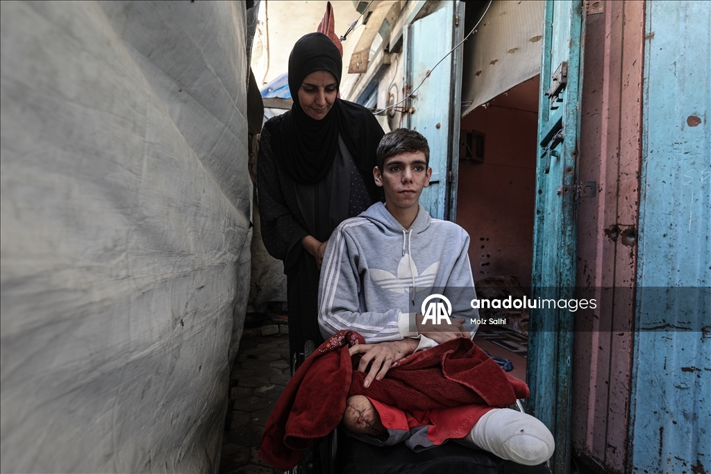 Потерявший обе ноги палестинец надеется на лечение за рубежом