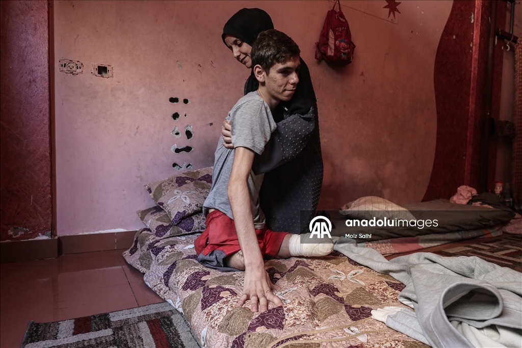 Потерявший обе ноги палестинец надеется на лечение за рубежом