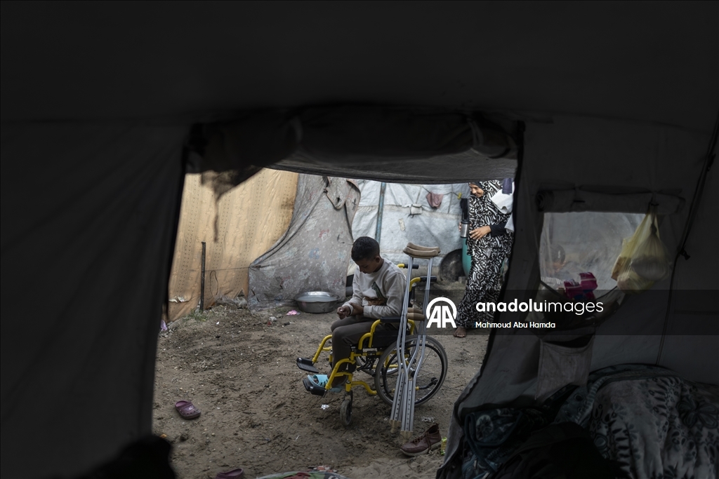 Лишившийся ноги маленький палестинец борется с вызовами с помощью семьи