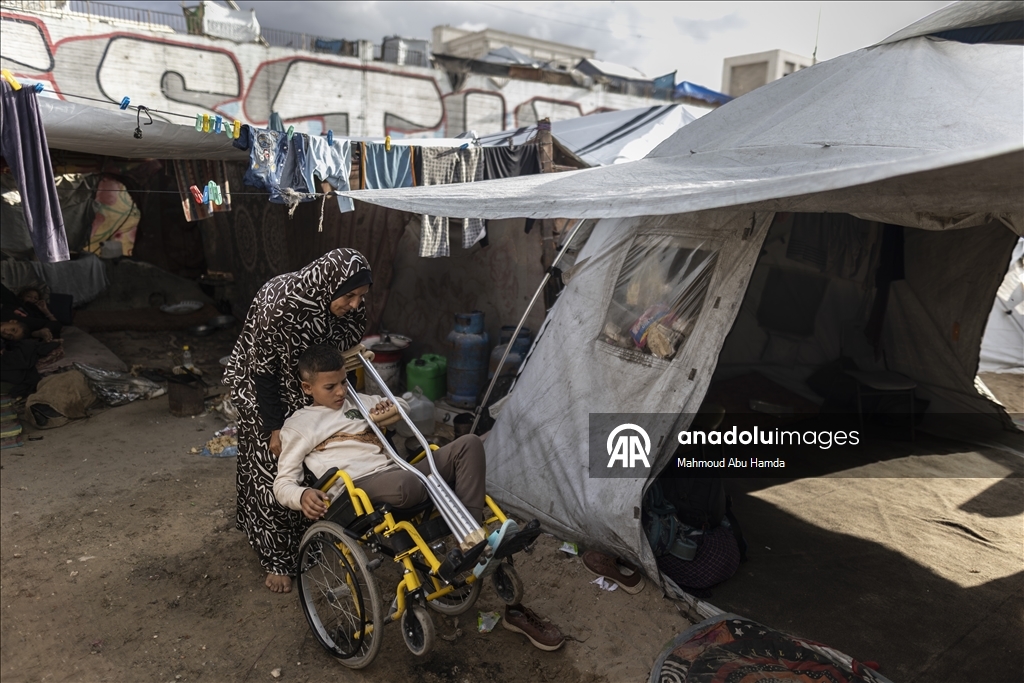 İsrail saldırısında bir bacağını kaybeden Filistinli çocuk ailesinin yardımıyla yaşama tutunuyor