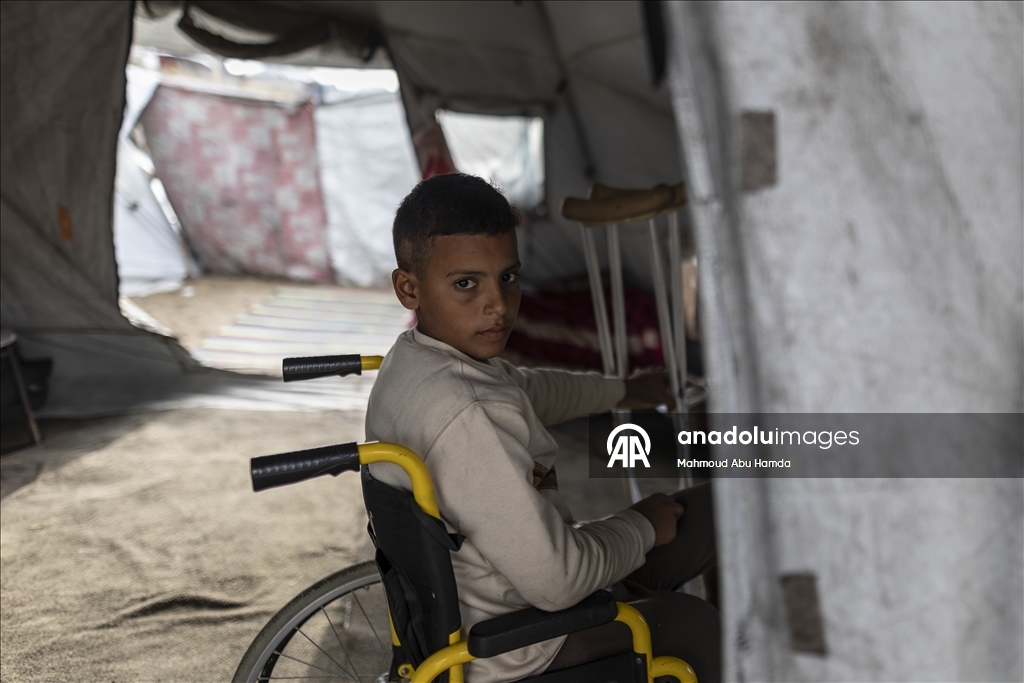 Лишившийся ноги маленький палестинец борется с вызовами с помощью семьи