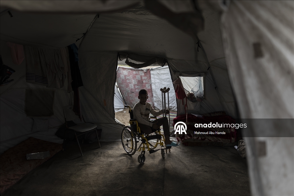 İsrail saldırısında bir bacağını kaybeden Filistinli çocuk ailesinin yardımıyla yaşama tutunuyor