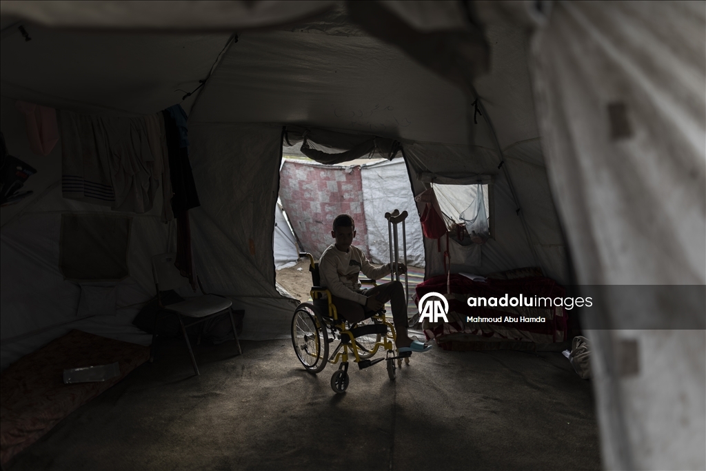 Лишившийся ноги маленький палестинец борется с вызовами с помощью семьи