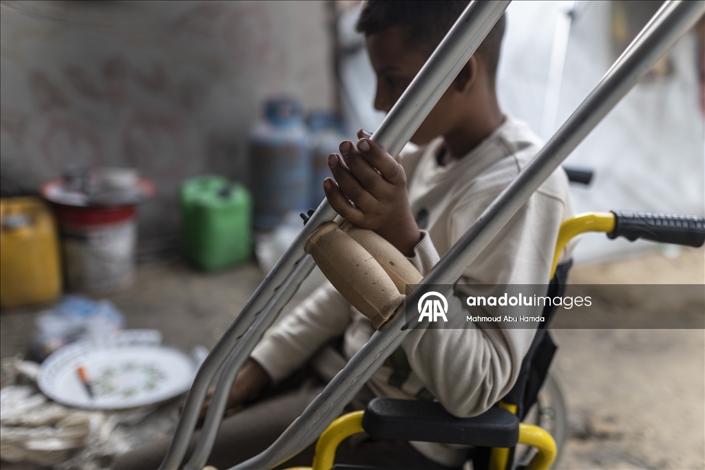 Лишившийся ноги маленький палестинец борется с вызовами с помощью семьи