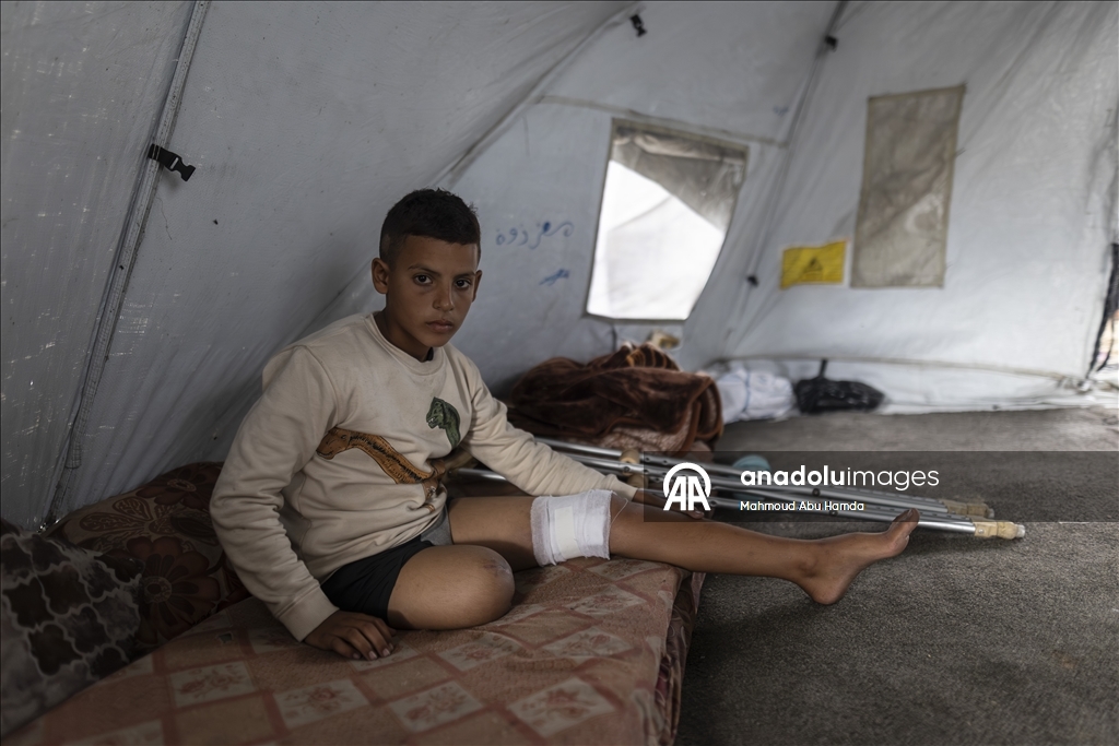 Лишившийся ноги маленький палестинец борется с вызовами с помощью семьи