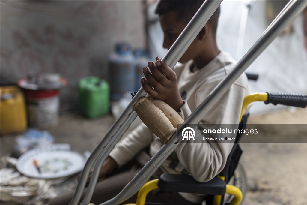 İsrail saldırısında bir bacağını kaybeden Filistinli çocuk ailesinin yardımıyla yaşama tutunuyor