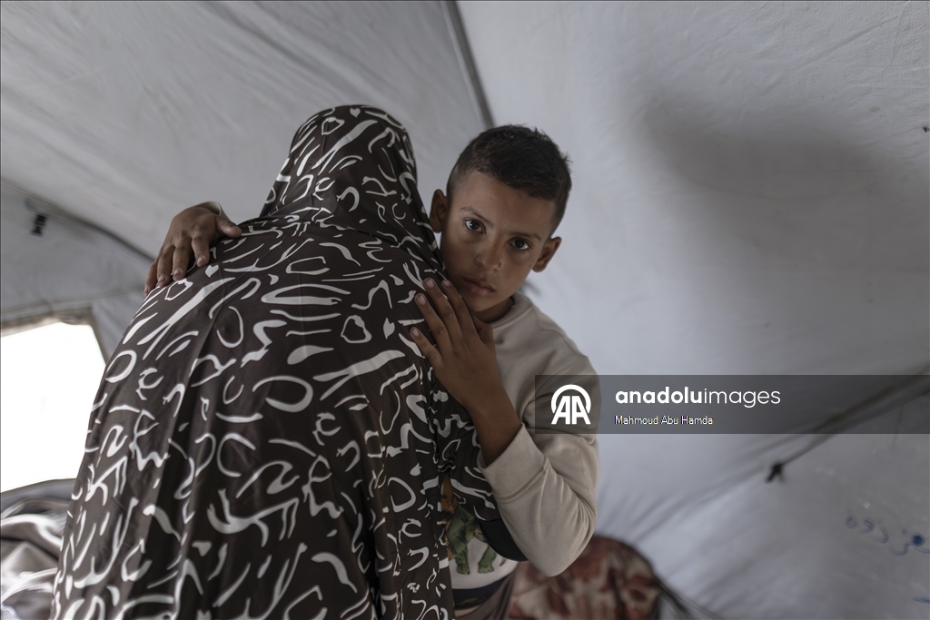 İsrail saldırısında bir bacağını kaybeden Filistinli çocuk ailesinin yardımıyla yaşama tutunuyor