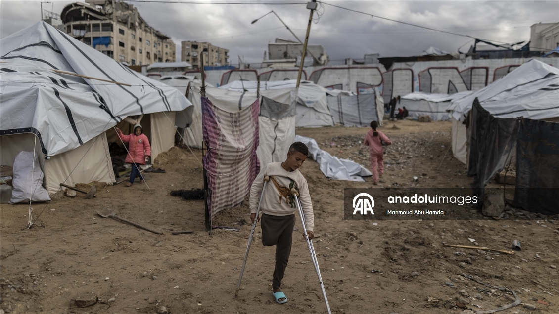 İsrail saldırısında bir bacağını kaybeden Filistinli çocuk ailesinin yardımıyla yaşama tutunuyor