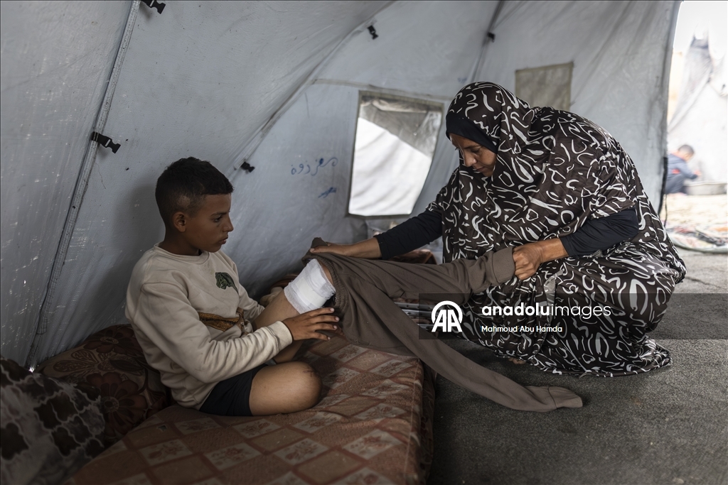 Лишившийся ноги маленький палестинец борется с вызовами с помощью семьи