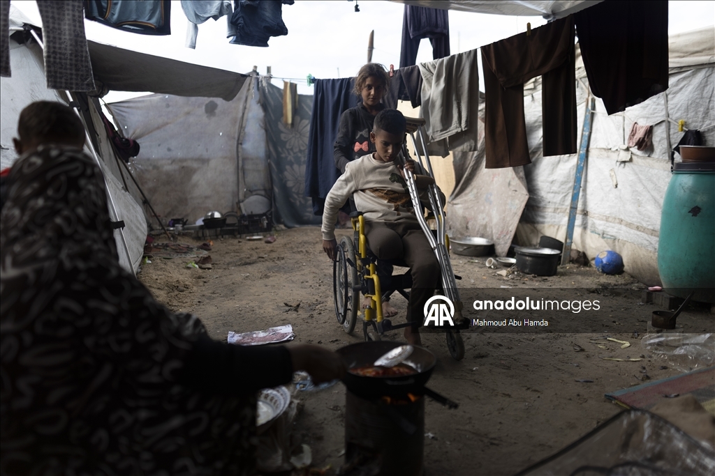 İsrail saldırısında bir bacağını kaybeden Filistinli çocuk ailesinin yardımıyla yaşama tutunuyor